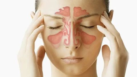 Understanding Chronic Sinusitis: Key Insights for Better Breathing and Relief